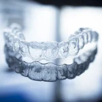 Aparat nakładkowy Invisalign z Warszawy